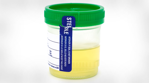 blog-drugtesting-500x280_0.png