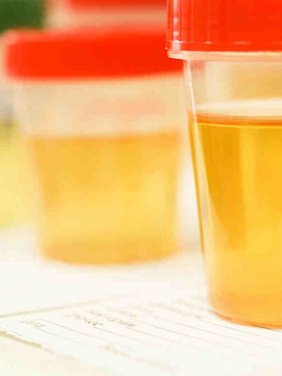 Drug testing