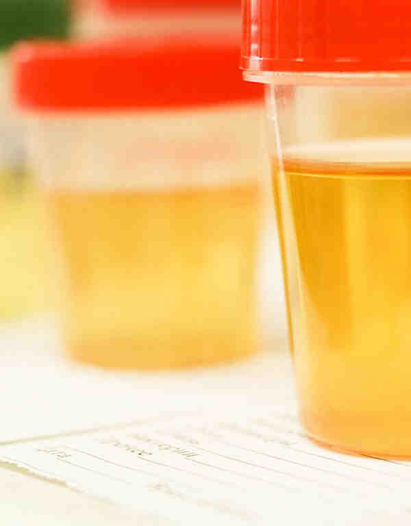 Drug testing